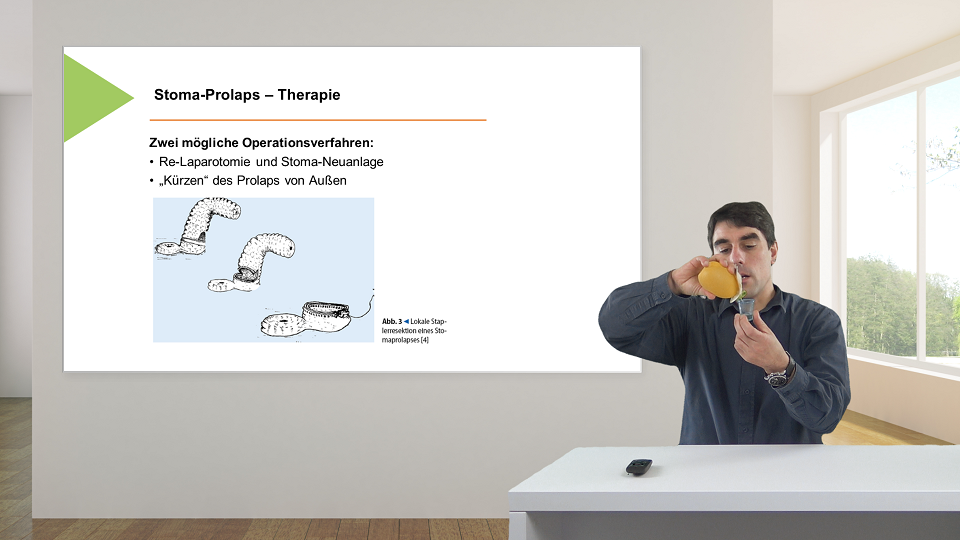 Vorschaubild zum Kurs: Stoma: Komplikationen